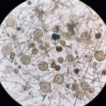 Phytoplankton. 📷 Robert Strzepek